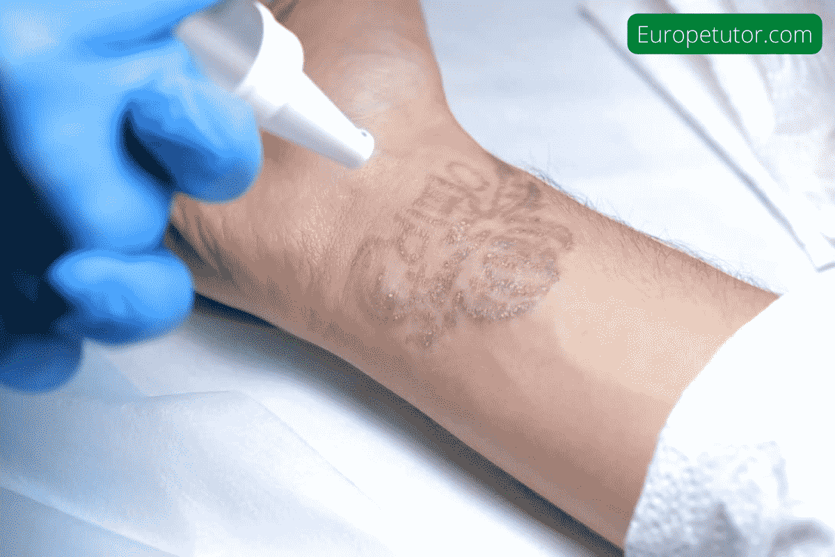 Can laser remove tattoos completely